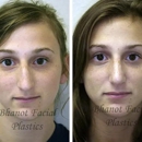Bhanot Facial Plastic Surgery - Physicians & Surgeons, Cosmetic Surgery