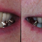 Smiles For Life Dental Care - Staunton