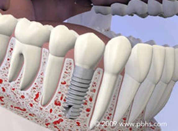 Raska Dental Implant & Oral Surgery - Sarasota, FL