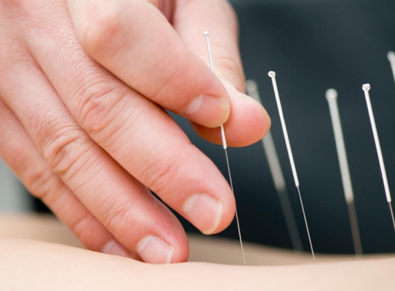 Cape Fear Acupuncture - Wilmington, NC