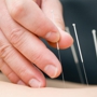 Cape Fear Acupuncture