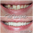 Just Smiles - General, Cosmetic & Implant Dentistry - Teeth Whitening Products & Services