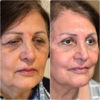 Assil Gaur Eye Institute of Los Angeles gallery