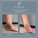 Vein Care Center - Physicians & Surgeons, Laser Surgery