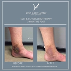 Vein Care Center